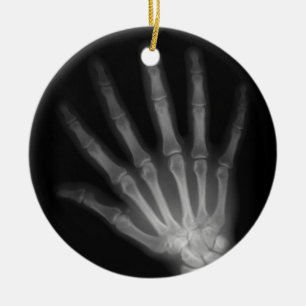 Extra Digit X-ray Left Hand Keramisch Ornament