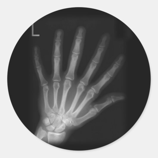 Extra Digit X-ray Left Hand Ronde Sticker (Voorkant)