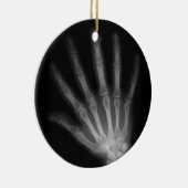 Extra Digit X-ray Right Hand Keramisch Ornament (Rechts)