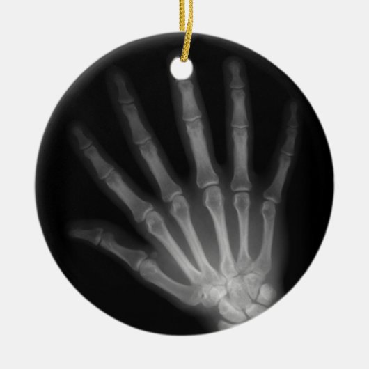 Extra Digit X-ray Right Hand Keramisch Ornament (Voorkant)