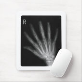 Extra Digit X-ray Right Hand Muismat (Met muis)