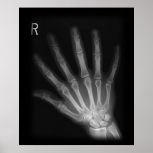 Extra Digit X-ray Right Hand Poster (Voorkant)
