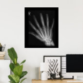 Extra Digit X-ray Right Hand Poster (Thuiskantoor)