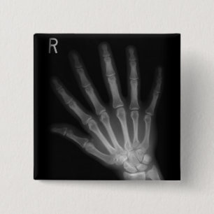 Extra Digit X-ray Right Hand Vierkante Button 5,1 Cm