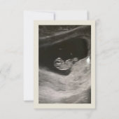 Faire-part bébé (Dos)