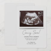 Faire-part Bébé à venir bientôt Échographie Grossesse (Devant / Derrière)