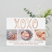 Faire-part de naissance 3 photos (XOXO) avec câlin (Debout devant)
