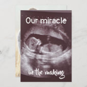 Faire-part Miracle In Making Ultrasound 2 Photo Baby Family (Devant / Derrière)