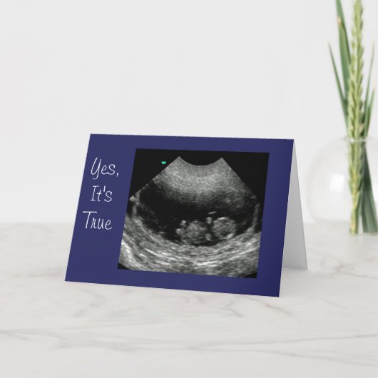 Faire-part Nouveau bébé Anouncement (Devant)