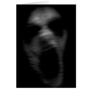 Falln Mental Disturbanes