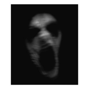 Falln Mental Disturbanes Foto Afdruk