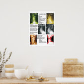 Fasen Poster van cervicale Spinale degeneratie (Keuken)