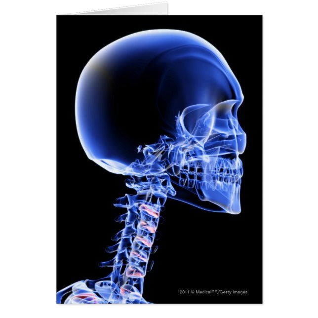 Fermez-vous vers le haut du rayon X des os dans le (Devant)