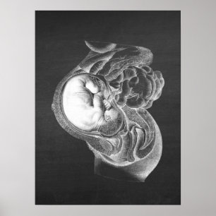 Fetus Womb Anatomy Obstetrics Decor no. 2 Poster
