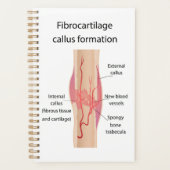 Fibrokraakbeen eeltvorming planner (Voorkant)