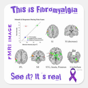 Fibromyalgie is echt. Je kunt het zien op een fMRI Vierkante Sticker