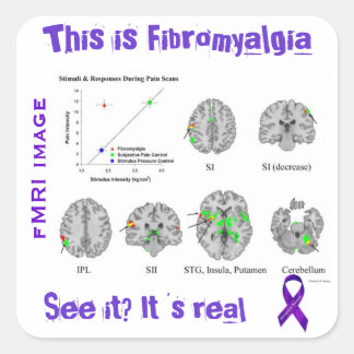 Fibromyalgie is echt. Je kunt het zien op een fMRI Vierkante Sticker