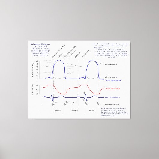 Figuur Canvas Afdruk (Voorkant)