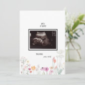 Fleur sauvage Ultrasound Photo Merci drôle (Debout devant)