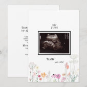 Fleur sauvage Ultrasound Photo Merci drôle (Devant / Derrière)