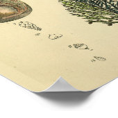 Foetale positie Pelvis Anatomie Kunst Afdrukken Poster (Hoek)