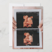 Foto Ultrasound Kerstmis Zwangerschap aankondiging (Achterkant)