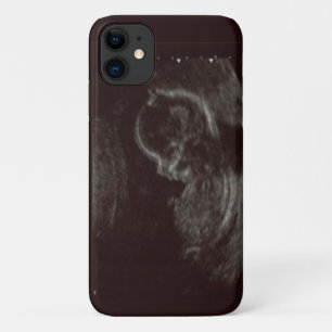Foto van je baby's iPhone 11 hoesje