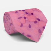 Fuches Dystrofie Stropdas (Opgerold)