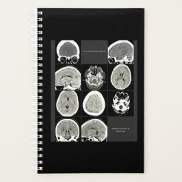 FullCTScan_thisis hoe depressie eruit ziet Planner