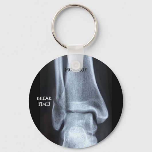 Funny Broken Fibula Xray "Pauze tijd" Sleutelhanger (Voorkant)