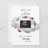 Garçon Ultrasound Funny Merci Baby Point de vue (Devant)