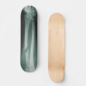 Gebroken Botten Skateboard (Voorkant)