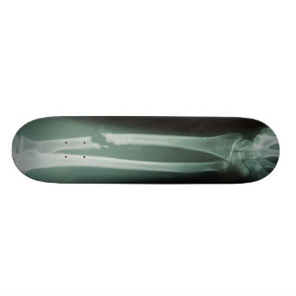 Gebroken Botten Skateboard