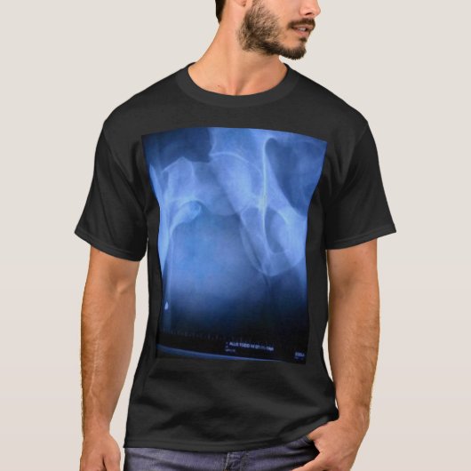 gebroken dijbeen t-shirt (Voorkant)