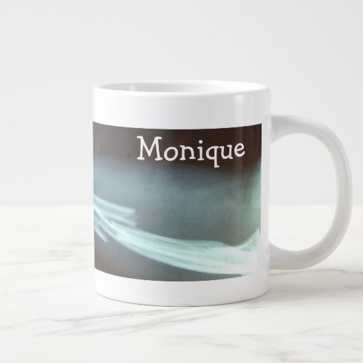 Gebroken spaakbeen en ellepijl "Pauze tijd" Extra Grote Beker (Rechts)