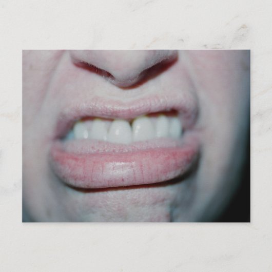 Geen glimlachen vandaag briefkaart (Voorkant)