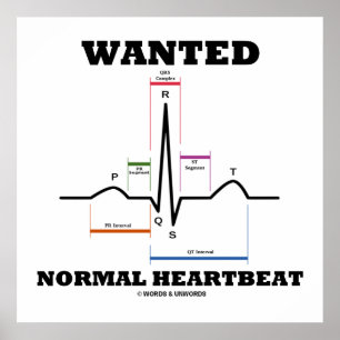 Gezocht normaal hartslag ECG-elektrocardiogram Poster