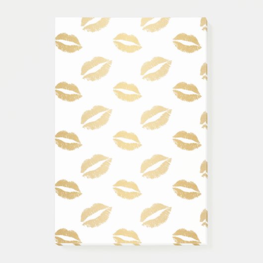 Glanzende Kusjes Post-it® Notes (Voorkant)