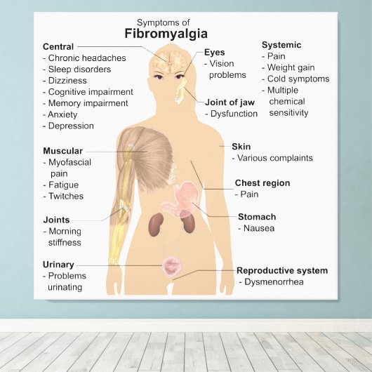 Grafiek Tekenen Symptomen Fibromyalgie Canvas Prin (Insitu (Houten vloer))