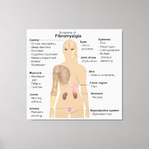 Grafiek Tekenen Symptomen Fibromyalgie Canvas Prin Afdruk