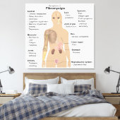 Grafiek Tekenen Symptomen Fibromyalgie Canvas Prin Afdruk (Insitu (Slaapkamer))