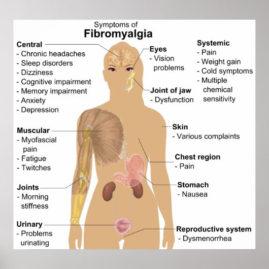 Grafiek van de symptomen van fibromyalgie poster (Voorkant)