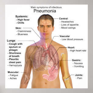 Grafiek van de symptomen van pneumonie poster