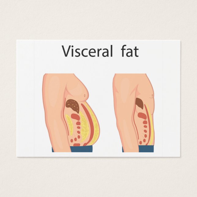 Graisse viscérale (Devant)