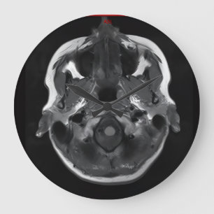Grande Horloge Ronde im dans votre tête xray mri scanner médical