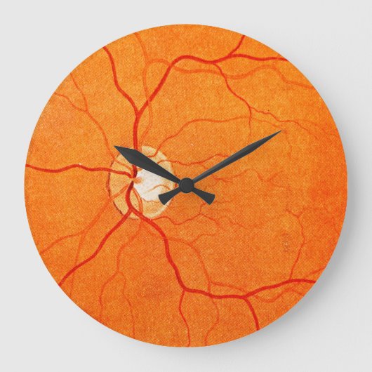 Grande Horloge Ronde Ophthalmology Optometry Eye Fundus Exam Wall Clock (Recto)