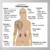 Graphique Signes communs + Symptômes Poster Fibrom (Devant)