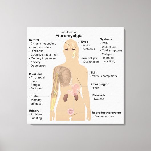 Graphique Signes Symptômes Fibromyalgie Impression (Recto)