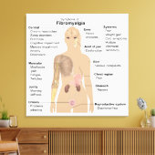 Graphique Signes Symptômes Fibromyalgie Impression (Insitu(Salon))