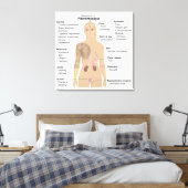 Graphique Signes Symptômes Fibromyalgie Impression (Insitu(Chambre))